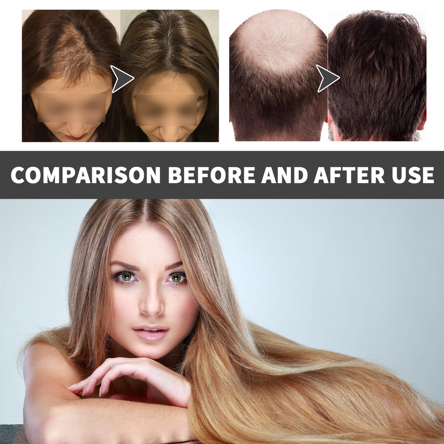 Hair Treatment Oil Improves Hair Dryness And Frizz