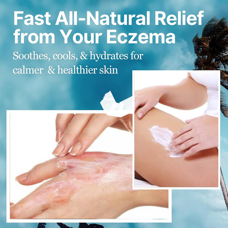 Seborrheic Dermatitis Psoriasis Folliculitis Care Cream Dry Scalp Face & Body Moisturizer With Anti Itch & Dandruff Relief